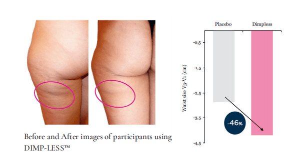 Dimp-Less - Cellulite Management (2 Month Supply)