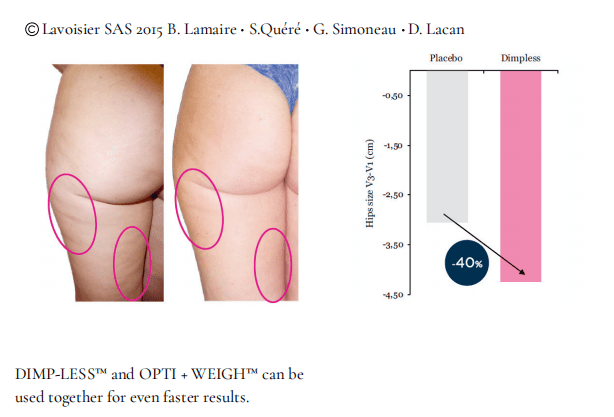 Dimp-Less - Cellulite Management (2 Month Supply)