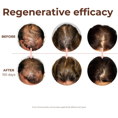 Standard Beauty - Peptide Miracle Hair Growth Serum | With Rosemary Extract & Plant-Stem-Cells
